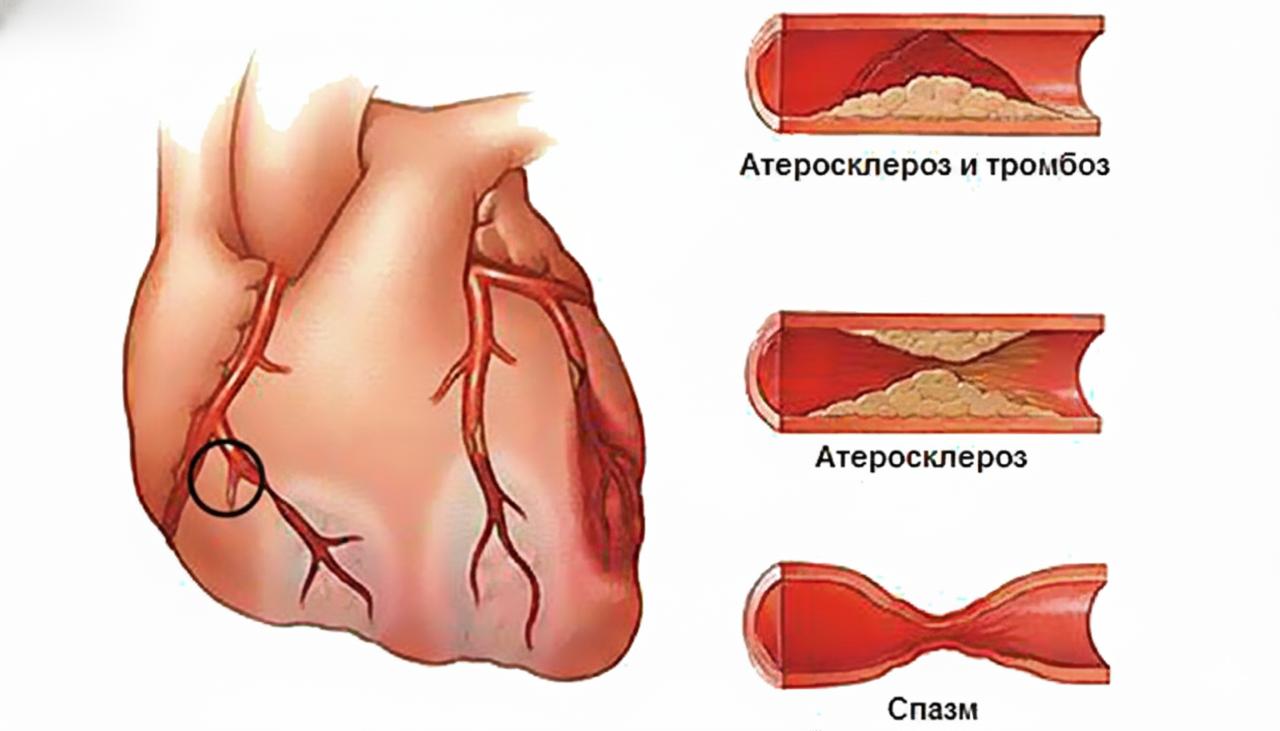 сердце